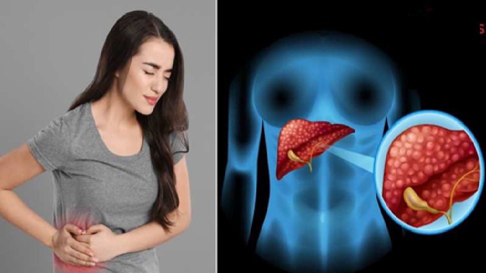 Gut Health: ಕರುಳಿನ ಆರೋಗ್ಯಕ್ಕೆ ಈ ಆಹಾರ ಸೇವಿಸಿ, ಇವುಗಳನ್ನ ತಿಂದ್ರೆ ನಿಮ್ಮ ಲಿವರ್ ಶುದ್ಧವಾಗುತ್ತೆ!!