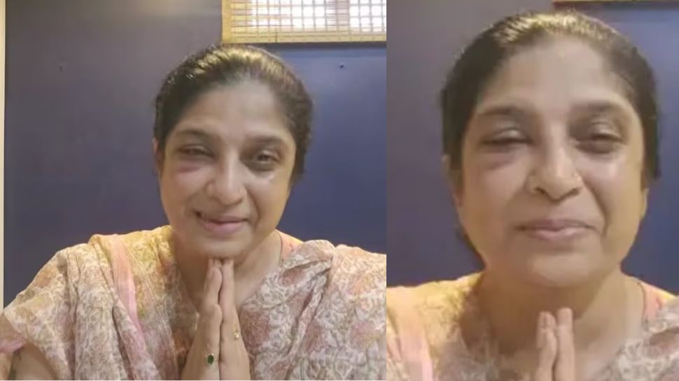 ಮುಖ ಊದಿಕೊಂಡು ಏಕಾಏಕಿ ಗುರುತೇ ಸಿಗದಂತಾದ ಖ್ಯಾತ ಹಿರಿಯ ನಟಿ! ಅಭಿಮಾನಿಗಳಲ್ಲಿ ಹೆಚ್ಚಾಯ್ತು ಆತಂಕ.. 
