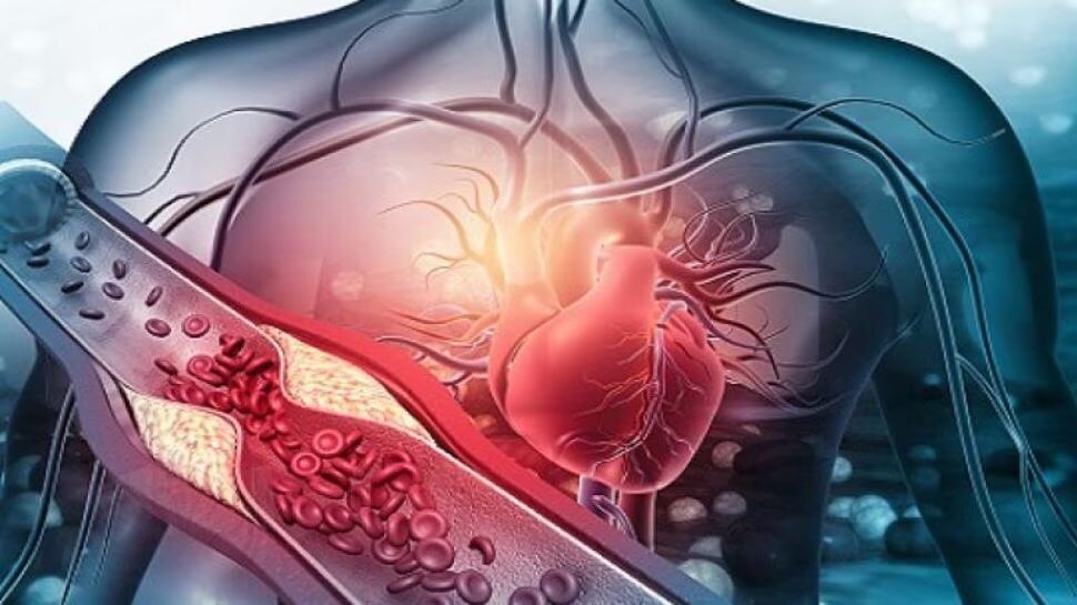 Heart Attack: ಹೃದಯಘಾತಕ್ಕೆ ಮುಖ್ಯ ಕಾರಣ ಕೊಲೆಸ್ಟ್ರಾಲ್‌ ಅಲ್ಲ! ಬೆಚ್ಚಿಬೀಳಿಸುವ ಸತ್ಯ ಬಿಚ್ಚಿಟ್ಟ ತಜ್ಞರು