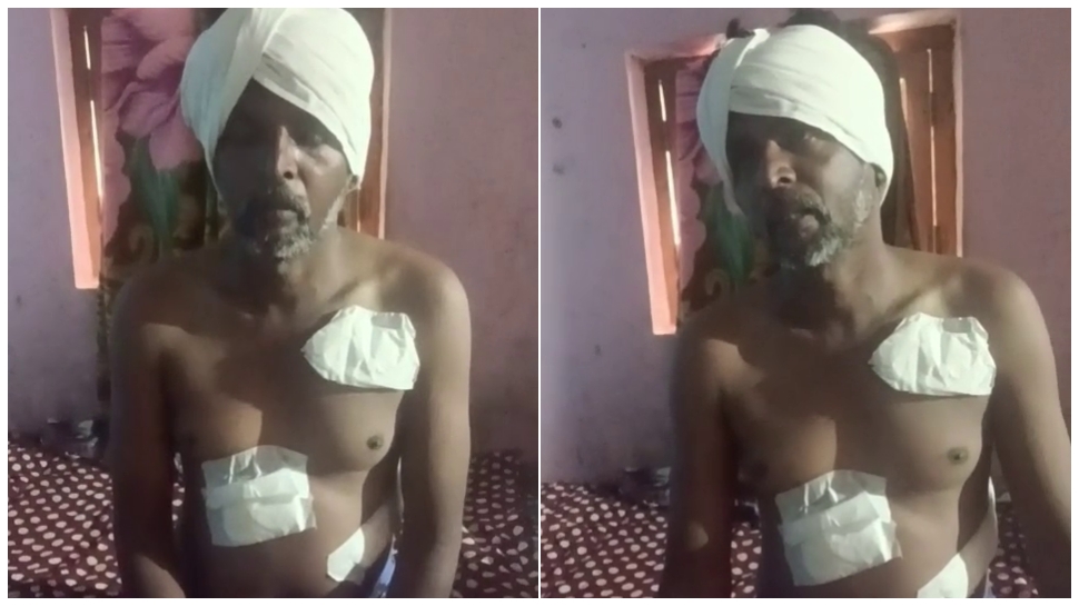 ಅಪ್ರಾಪ್ತ ಬಾಲಕಿಯನ್ನ ಚುಡಾಯಿಸಿ ಮದುವೆಗೆ ಒತ್ತಾಯ : ವಿರೋಧಿಸಿದ ತಂದೆಗೆ ಚೂರಿ ಇರಿದ ಯುವಕ ಅಪ್ರಾಪ್ತ ಬಾಲಕಿಯನ್ನ ಚುಡಾಯಿಸಿ ಮದುವೆಗೆ ಒತ್ತಾಯ : ವಿರೋಧಿಸಿದ ತಂದೆಗೆ ಚೂರಿ ಇರಿದ ಯುವಕ