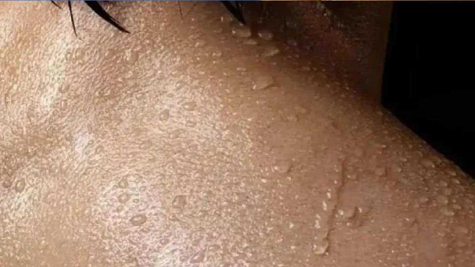 Do you know which part of body does not sweat | ದೇಹದ ಈ ಒಂದು ಭಾಗ ಮಾತ್ರ ...