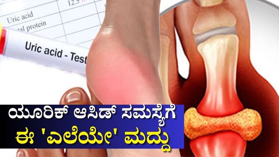 Uric Acid: ಕೇವಲ 2 ರೂ.ಗೆ ಸಿಗುವ ಈ ಎಲೆಯನ್ನು ಜಗಿದು ತಿಂದ್ರೆ ಕೀಲುಗಳಲ್ಲಿ ಹರಳುಗಟ್ಟಿದ ಯೂರಿಕ್ ಆಮ್ಲ ಸುಲಭವಾಗಿ ಕರಗುತ್ತೆ