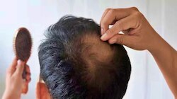 ತಲೆಯಲ್ಲಿ ಕೂದಲು ತುಂಬಾ ಉದುರೋಗಿದೆಯೇ.? ಹಾಗಿದ್ರೆ ಈ ಬೀಜ ಉಪಯೋಗಿಸಿ ದಟ್ಟವಾಗಿ ಬೆಳೆಯುತ್ತವೆ