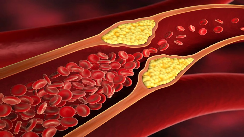 ರಕ್ತನಾಳಗಳಲ್ಲಿ ಅಂಟಿ ಕುಳಿತ ಕೆಟ್ಟ ಕೊಲೆಸ್ಟ್ರಾಲ್ ಕರಗಿಸುವ ಧಾನ್ಯಗಳು! ತೂಕ ಇಳಿಕೆಗೂ ಇವಷ್ಟೇ ಮದ್ದು..