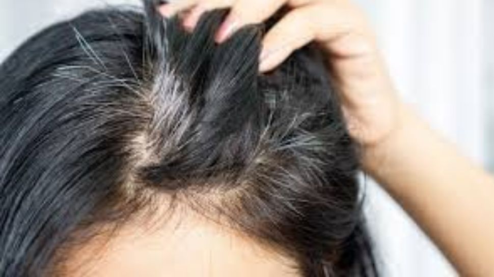 White Hair Remedies