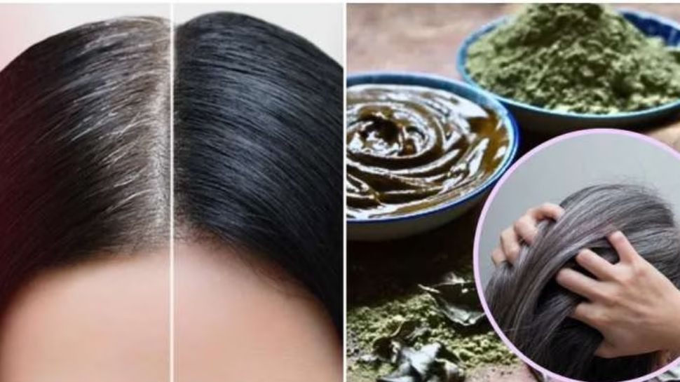 White Hair Home Remedies