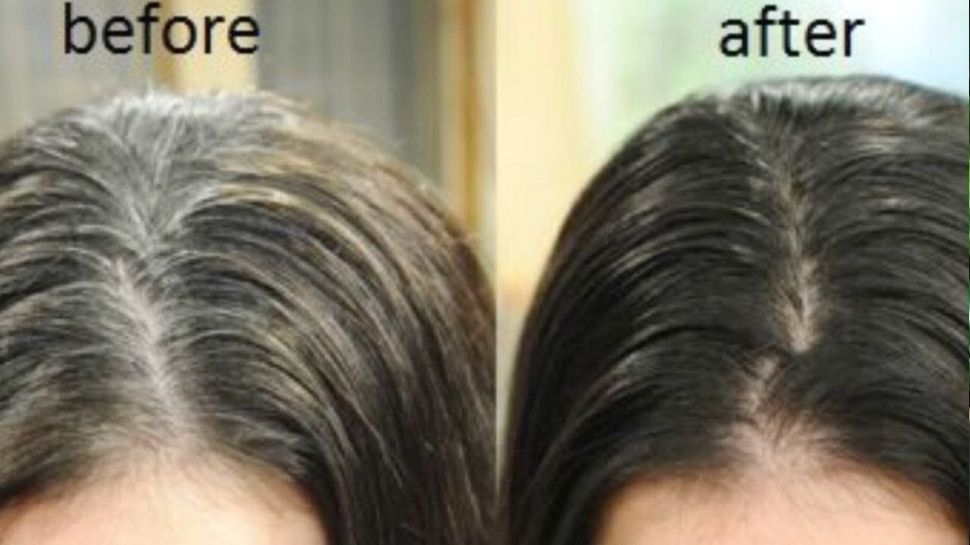 Kalonji Oil for White Hair