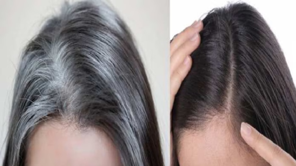Natural white hair home remedies | ಬಿಳಿ ಕೂದಲಿಗೆ ಶಾಶ್ವತ ಪರಿಹಾರ ಚಿಟಿಕೆ