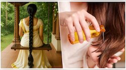 ಬೋಳು ತಲೆಯಲ್ಲೂ ಚಿಗುರುತ್ತವೆ ಕೂದಲು.. ಜಸ್ಟ್‌ ಈ ಎಣ್ಣೆಯನ್ನು ಪ್ರತಿನಿತ್ಯ ಹಚ್ಚಿ ಸಾಕು..! ದುಬಾರಿ ಏನಲ್ಲ
