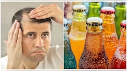 Hair loss : ಕೂಲ್ ಡ್ರಿಂಕ್ಸ್ ಕುಡಿಯುವುದರಿಂದ ಕೂದಲು ಉದುರುತ್ತದೆಯೇ? ಸತ್ಯ ತಿಳಿದರೆ ನಿಮಗೆ ಶಾಕ್ ಆಗುತ್ತೆ