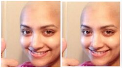 ಕೂದಲು ಉದುರಿ, ತಲೆ ಬೋಳಾಗಿ ಗುರುತು ಸಿಗದಂತೆ ಬದಲಾದ ಕನ್ನಡ ನಟಿ..! ಏನಾಯ್ತು?