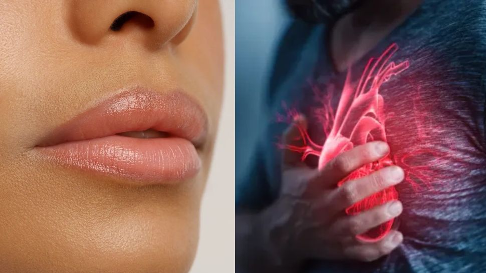 Heart Problem Lips heart disease warning symptoms that appear on lips | ನಿಮ್ಮ ತುಟಿಯಲ್ಲಿ ಈ ...