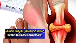 ಕೀಲುಗಳಲ್ಲಿ ಹರಳುಗಟ್ಟಿರುವ ಯೂರಿಕ್‌ ಆಮ್ಲವನ್ನು ಕೆಲವೇ ನಿಮಿಷಗಳಲ್ಲಿ ಮಂಜಿನಂತೆ ಕರಗಿಸುವ ಆಹಾರಗಳಿವು