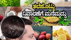 ತಲೆಹೊಟ್ಟು ನಿವಾರಣೆಗೆ ಸರಳ ಮನೆಮದ್ದುಗಳು: ಮೊದಲ ಬಳಕೆಯಲ್ಲೇ ರಿಸಲ್ಟ್‌ ಪಕ್ಕಾ!