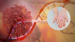 Cancer: ದೇಹದಲ್ಲಿ ಪದೇ ಪದೇ ಈ ಸಮಸ್ಯೆ ಕಾಣಿಸಿಕೊಳ್ತಿದ್ಯಾ? ಹಾಗಿದ್ರೆ ಹುಷಾರ್‌, ಕ್ಯಾನ್ಸರ್‌ ಲಕ್ಷಣವಾಗಿರಬಹುದು