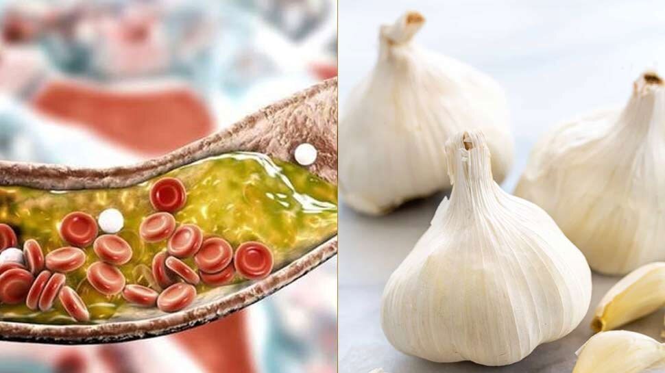 Amazing Health Benefits of Eating Garlic in diet ದೈನಂದಿನ ಆಹಾರದಲ್ಲಿ