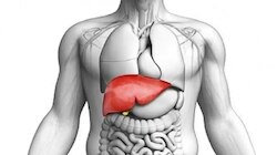 Fatty Liver Disease: ಕೇವಲ ಅಲ್ಕೋಹಾಲ್ ನಿಂದ ಮಾತ್ರ ಅಲ್ಲ, ಈ ಅಭ್ಯಾಸಗಳಿಂದಲೂ ಫ್ಯಾಟಿ ಲಿವರ್ ಸಮಸ್ಯೆ ಎದುರಾಗಬಹುದು
