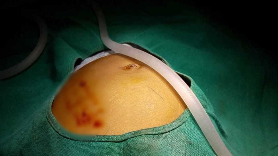 Fetus found in uterus of 9 months baby | PHOTOS: 9 ತಿಂಗಳ ...