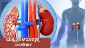 Liver Detoxification: ಯಕೃತ್ತಿನಲ್ಲಿ ಶೇಖರಣೆಗೊಂಡ ಕೊಳೆಯನ್ನು ಕೆಲವೇ ನಿಮಿಷಗಳಲ್ಲಿ ಹೊರಹಾಕುತ್ತವೆ ಈ ಸಂಗತಿಗಳು!