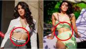 ʼದಿ ಕೇರಳ ಸ್ಟೋರಿʼ ನಟಿ ಹೊಟ್ಟೆಗೆ ಶಸ್ತ್ರ ಚಿಕಿತ್ಸೆ..! ಆಗಿದ್ದೇನು ಗೊತ್ತಾ..?