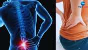Back Pain Remedies: ನಿತ್ಯ ಈ 5 ಕೆಲಸ ಮಾಡುವುದರಿಂದ ಬೆನ್ನು ನೋವಿಗೆ ಸಿಗುತ್ತೆ ಶಾಶ್ವತ ಪರಿಹಾರ 