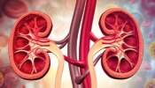  World Kidney Day 2025: ಮಕ್ಕಳಲ್ಲಿ ಹೆಚ್ಚುತ್ತಿರುವ ಕಿಡ್ನಿ ಸಮಸ್ಯೆಗೆ ಕಾರಣವೇನು ಗೊತ್ತಾ.?