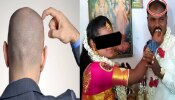 ʼನಿನ್ನ ಜೊತೆ ಹೊರಗೆ ಹೋಗಲು ನನಗೆ ನಾಚಿಕೆ ಆಗುತ್ತೆʼ; ಬೋಳುತಲೆ ಬಗ್ಗೆ ಪತ್ನಿ ಗೇಲಿಗೆ ನೊಂದ ಪತಿ ನೇಣಿಗೆ ಶರಣು!
