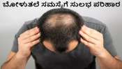 ಕೂದಲು ಅತಿಯಾಗಿ ಉದುರಲು ದೇಹದಲ್ಲಿ ಈ ವಿಟಮಿನ್‌ ಕೊರತೆಯೇ ಕಾರಣ..! ಈ ಸಮಸ್ಯೆಗೆ ಶಾಶ್ವತ ಪರಿಹಾರ ಪಡೆಯಲು ಇಲ್ಲಿದೆ ಸುಲಭ ಟಿಪ್ಸ್