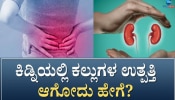 ಕಿಡ್ನಿ ಸ್ಟೋನ್‌ಗೆ ಕಾರಣವೇನು? ಈ ಗಂಭೀರ ಕಾಯಿಲೆಯಿಂದ ಪಾರಾಗುವುದು ಹೇಗೆ?