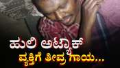 ಬಹಿರ್ದೆಸೆ‌ ಮುಗಿಸಿ ಮನೆಗೆ ತೆರಳುತ್ತಿದ್ದವನ‌ ಮೇಲೆ ಎಗರಿದ ಹುಲಿರಾಯ:  ವ್ಯಕ್ತಿಗೆ ತೀವ್ರ ಗಾಯ 