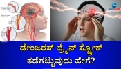 ಈ ರೀತಿಯ ಲಕ್ಷಣಗಳು ಕಂಡುಬಂದ್ರೆ ನಿಮಗೆ ಬ್ರೇನ್‌ ಸ್ಟ್ರೋಕ್‌ ಆಗುತ್ತೆ ಎಂದರ್ಥ: ಕೂಡಲೇ ಎಚ್ಚರವಹಿಸಿ