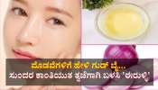ಮುಖದಲ್ಲಿ ಮೂಡಿರುವ ಮೊಡವೆಗಳಿಗೆ ಗುಡ್ ಬೈ ಹೇಳಿ... ಕ್ಲಿಯರ್ ಸ್ಕಿನ್ ಪಡೆಯಲು ಅತ್ಯುತ್ತಮ ಮದ್ದು &#039;ಈರುಳ್ಳಿ ರಸ&#039;  