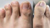 ಕಾಲ್ಬೆರಳುಗಳ ಮೇಲೆ ಬೆಳೆಯುವ ಕೂದಲಿನಲ್ಲಿ ಅಡಗಿದೆ ನಿಮ್ಮ ಆರೋಗ್ಯದ ಗುಟ್ಟು.. ನಿರ್ಲಕ್ಷ್ಯ ಮಾಡಿದ್ರೆ ಆಗುವ ಸಮಸ್ಯೆಗಳೇನು ಗೊತ್ತಾ? ಕಾಲ್ಬೆರಳುಗಳ ಮೇಲೆ ಬೆಳೆಯುವ ಕೂದಲಿನಲ್ಲಿ ಅಡಗಿದೆ ನಿಮ್ಮ ಆರೋಗ್ಯದ ಗುಟ್ಟು.. ನಿರ್ಲಕ್ಷ್ಯ ಮಾಡಿದ್ರೆ ಆಗುವ ಸಮಸ್ಯೆಗಳೇನು ಗೊತ್ತಾ?
