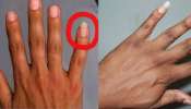 ಗಂಡಸರು ಪುಟ್ಟ ಬೆರಳಿನ ಉಗುರನ್ನು ಉದ್ದ ಬೆಳೆಸುವುದರ ಹಿಂದಿನ ಅಸಲಿ ಸೀಕ್ರೆಟ್ ಇದೇ! ಅಲಂಕಾರಕ್ಕಲ್ಲ.. ಅಸಲಿ ಕಾರಣ ತಿಳಿದ್ರೆ ಶಾಕ್ ಆಗ್ತೀರಿ.. ಗಂಡಸರು ಪುಟ್ಟ ಬೆರಳಿನ ಉಗುರನ್ನು ಉದ್ದ ಬೆಳೆಸುವುದರ ಹಿಂದಿನ ಅಸಲಿ ಸೀಕ್ರೆಟ್ ಇದೇ! ಅಲಂಕಾರಕ್ಕಲ್ಲ.. ಅಸಲಿ ಕಾರಣ ತಿಳಿದ್ರೆ ಶಾಕ್ ಆಗ್ತೀರಿ..
