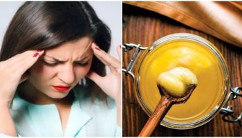 Migraine ನೋವು ನಿವಾರಣೆಗೆ ದೇಸಿ ತುಪ್ಪ, ಶುಂಠಿ ಹಾಗೂ ದಾಲ್ಚಿನಿ ಮನೆಮದ್ದು 