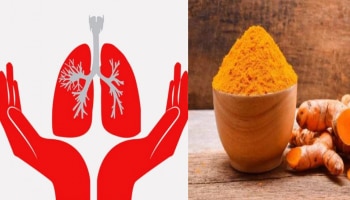 Turmeric for TB : ನಿಮಗೆ ಗೊತ್ತಿದೆಯಾ ಟಿಬಿ ರೋಗಕ್ಕೂ ರಾಮಬಾಣ ಅಡುಗೆ ಮನೆ ಅರಿಶಿನ 