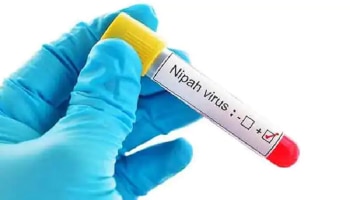 Nipah Virus Update: ಕೇರಳದಲ್ಲಿ ಹೆಚ್ಚಾಗುತ್ತಿರುವ ನಿಪಾಹ್ ವೈರಸ್ ಪ್ರಕೋಪ, ಬೇರೆ ರಾಜ್ಯಗಳಿಗೆ ಏನು ಆತಂಕ?