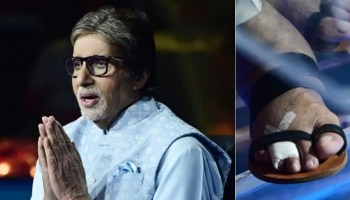 Amitabh Bachchan: ಗಾಯದ ನಡುವೆಯೂ KBC ಶೋ ನಲ್ಲಿ ಭಾಗವಹಿಸಿದ ಅಮಿತಾಬ್ ಬಚ್ಚನ್