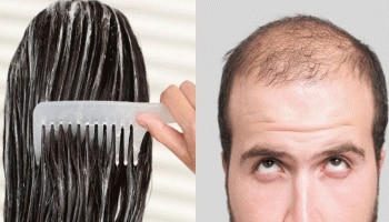 Hair Care Tips: ಹೇರ್ ಕಂಡೀಷನರ್ ಹಚ್ಚುವುದರಿಂದ ಕೂದಲು ಉದುರುತ್ತದೆಯೇ?