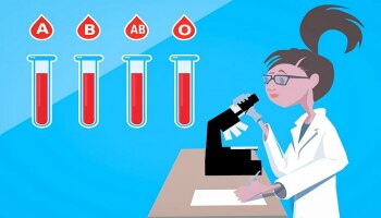 Coronavirus Risk: ಈ ರಕ್ತದ ಗುಂಪುಗಳಿಗೆ COVID-19 ಅಪಾಯ ಹೆಚ್ಚು.. ನಿಮ್ಮ blood group ಇದೆಯಾ ಪರೀಕ್ಷಿಸಿಕೊಳ್ಳಿ!