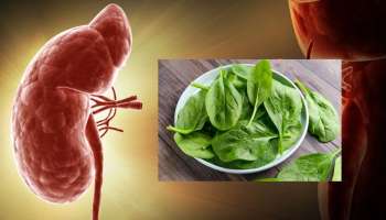 Kidney Food: ಆರೋಗ್ಯಕರ ಕಿಡ್ನಿಗಾಗಿ ಈ 5 ಆಹಾರಗಳನ್ನು ಮಿಸ್ ಮಾಡದೇ ನಿಮ್ಮ ಡಯಟ್ನಲ್ಲಿ ಸೇರಿಸಿ