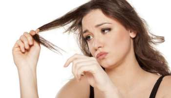 Hair Problems : ಕೂದಲಿನ ಸಮಸ್ಯೆಗಳಿಗೆ ಪ್ರತಿದಿನ ಸೇವಿಸಿ ಈ ತರಕಾರಿ! 