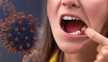 COVID Teeth: ಕರೋನಾದ ನಾಲ್ಕನೇ ಅಲೆಯಲ್ಲಿ ಹಲ್ಲುಗಳಿಗೆ ಅಪಾಯ! ಈ  6 ಲಕ್ಷಣಗಳನ್ನು ನಿರ್ಲಕ್ಷಿಸಬೇಡಿ