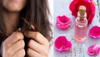 Hair Remedies: ಈ ರಸದಿಂದ ಕೂದಲಿನ ಸಮಸ್ಯೆ ಒಂದೇ ದಿನದಲ್ಲಿ ಮಾಯವಾಗುತ್ತೆ! 