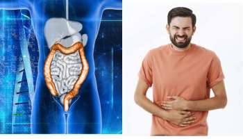 Colon Cancer Causes : ಈ ಆಹಾರ ಸೇವನೆಯಿಂದಲೇ ಹೆಚ್ಚುತ್ತದೆ  ಕರುಳಿನ  ಕ್ಯಾನ್ಸರ್. ! 