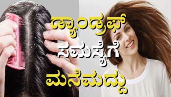 Dandruff Remedies: ತಲೆಹೊಟ್ಟಿನ ಸಮಸ್ಯೆಯಿಂದ ಮುಕ್ತಿ ಪಡೆಯಲು ನೈಸರ್ಗಿಕ ಮನೆಮದ್ದುಗಳು 