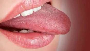 Tongue colour : ನಾಲಿಗೆಯ ಬಣ್ಣ, ಆಕಾರದಿಂದಲೇ ವ್ಯಕ್ತಿಯ ಗುಣಗಳನ್ನು ತಿಳಿಯಿರಿ! 