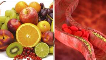 High Cholesterol: ರಕ್ತನಾಳಗಳಲ್ಲಿ ಸಂಗ್ರಹವಾಗಿರುವ ಕೊಲೆಸ್ಟ್ರಾಲ್ ಕರಗಿಸಲು ಚಳಿಗಾಲದಲ್ಲಿ ಈ ಹಣ್ಣುಗಳನ್ನು ಸೇವಿಸಿ 