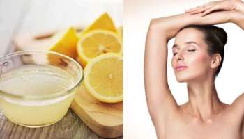 Remedy for Dark Underarms: ಕಪ್ಪು ಕಂಕುಳ ಸಮಸ್ಯೆಗೆ ಈ ಹಣ್ಣಿನ ರಸ ಸುಲಭ ಪರಿಹಾರ: ಚಿಟಿಕೆಯಲ್ಲಿ ಫಲಿತಾಂಶ ಖಂಡಿತ