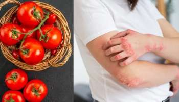 Tomato Side Effects: ಅತಿಯಾದ ಟೊಮೊಟೊ ಸೇವನೆಯಿಂದ ಕಾಡುತ್ತೆ ಈ ಆರೋಗ್ಯ ಸಮಸ್ಯೆ.!